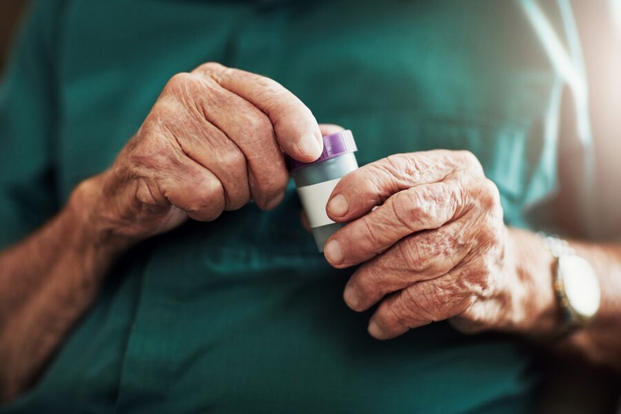 : Treatments for Osteoarthritis in Hands – TAE for Hand Arthritis